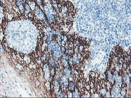 FXYD3 Antibody - IHC of paraffin-embedded Human tonsil using anti-FXYD3 mouse monoclonal antibody.
