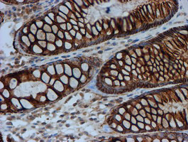 FXYD3 Antibody - IHC of paraffin-embedded Human colon tissue using anti-FXYD3 mouse monoclonal antibody. (Heat-induced epitope retrieval by 10mM citric buffer, pH6.0, 100C for 10min).