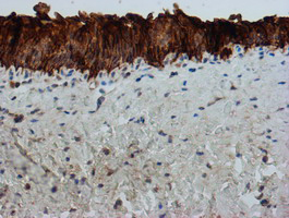FXYD3 Antibody - IHC of paraffin-embedded Human bladder tissue using anti-FXYD3 mouse monoclonal antibody. (Heat-induced epitope retrieval by 10mM citric buffer, pH6.0, 100C for 10min).