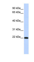 FXYD5 / Dysadherin Antibody - FXYD5 antibody Western blot of Fetal Heart lysate. This image was taken for the unconjugated form of this product. Other forms have not been tested.