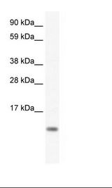 FXYD5 / Dysadherin Antibody - Placenta Lysate.  This image was taken for the unconjugated form of this product. Other forms have not been tested.