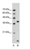FXYD5 / Dysadherin Antibody - Jurkat Cell Lysate.  This image was taken for the unconjugated form of this product. Other forms have not been tested.