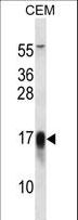 FXYD5 / Dysadherin Antibody - FXYD5 Antibody western blot of CEM cell line lysates (35 ug/lane). The FXYD5 antibody detected the FXYD5 protein (arrow).