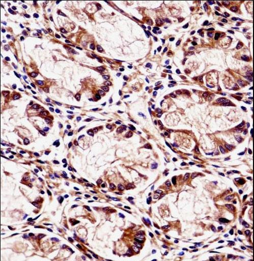 FXYD5 / Dysadherin Antibody - FXYD5 Antibody immunohistochemistry of formalin-fixed and paraffin-embedded human rectum tissue followed by peroxidase-conjugated secondary antibody and DAB staining.