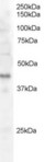 FXYD5 / Dysadherin Antibody - Antibody staining (0.5 ug/ml) of Jurkat lysate (RIPA buffer, 30 ug total protein per lane). Primary incubated for 1 hour. Detected by Western blot of chemiluminescence.