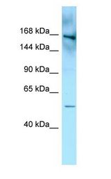 FYCO1 Antibody - FYCO1 antibody Western Blot of MDA-MB-435S.  This image was taken for the unconjugated form of this product. Other forms have not been tested.