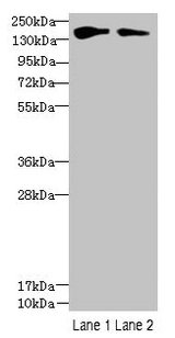 FYCO1 Antibody - Western blot All lanes: FYCO1 antibody at 2.5µg/ml Lane 1: HepG2 whole cell lysate Lane 2: Mouse liver tissue Secondary Goat polyclonal to rabbit IgG at 1/10000 dilution Predicted band size: 167, 44, 169 kDa Observed band size: 167 kDa
