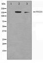 FYCO1 Antibody - Western blot of A549 and HUVEC cell lysate using FYCO1 Antibody