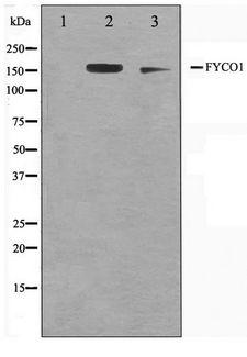 FYCO1 Antibody - Western blot of A549 and HUVEC cell lysate using FYCO1 Antibody