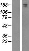 FYCO1 Protein - Western validation with an anti-DDK antibody * L: Control HEK293 lysate R: Over-expression lysate