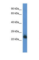 FYTTD1 Antibody - FYTTD1 antibody Western blot of 721_B Cell lysate. Antibody concentration 1 ug/ml.  This image was taken for the unconjugated form of this product. Other forms have not been tested.