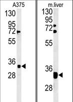 FYTTD1 Antibody - (LEFT)Western blot of FYTD1 Antibody in A375 cell line lysates (35 ug/lane). FYTD1 (arrow) was detected using the purified antibody.(RIGHT)Western blot of FYTD1 Antibody in mouse liver tissue lysates (35 ug/lane). FYTD1 (arrow) was detected using the purified antibody.