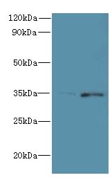 FYTTD1 Antibody - Western blot. All lanes: FYTTD1 antibody at 4 ug/ml. Lane 1: A375 whole cell lysate. Lane 2: Jurkat whole cell lysate. Secondary Goat polyclonal to Rabbit IgG at 1:10000 dilution. Predicted band size: 36 kDa. Observed band size: 36 kDa.