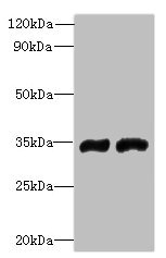 FYTTD1 Antibody - Western blot All lanes: FYTTD1 antibody at 4µg/ml Lane 1: A375 whole cell lysate Lane 2: Jurkat whole cell lysate Secondary Goat polyclonal to rabbit IgG at 1/10000 dilution Predicted band size: 36, 34, 29, 15 kDa Observed band size: 36 kDa