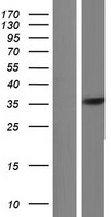 FYTTD1 Protein - Western validation with an anti-DDK antibody * L: Control HEK293 lysate R: Over-expression lysate