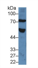 FZD1 / Frizzled 1 Antibody - Western Blot; Sample: Human Serum; Primary Ab: 5µg/ml Rabbit Anti-Human FZD1 Antibody Second Ab: 0.2µg/mL HRP-Linked Caprine Anti-Rabbit IgG Polyclonal Antibody