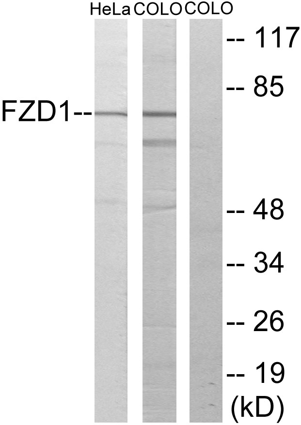 FZD1 / Frizzled 1 Antibody - Western blot analysis of lysates from HeLa and COLO205 cells, using FZD1 Antibody. The lane on the right is blocked with the synthesized peptide.