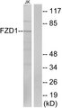 FZD1 / Frizzled 1 Antibody - Western blot analysis of lysates from Jurkat cells, using FZD1 Antibody. The lane on the right is blocked with the synthesized peptide.