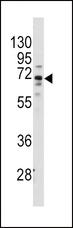 FZD1 / Frizzled 1 Antibody - Western blot of anti-FZD1 Antibody in HeLa cell line lysates (35 ug/lane). FZD1(arrow) was detected using the purified antibody.