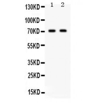 FZD1 / Frizzled 1 Antibody - Frizzled homolog 1 antibody Western blot. All lanes: Anti Frizzled homolog 1 at 0.5 ug/ml. Lane 1: 22RV1 Whole Cell Lysate at 40 ug. Lane 2: 293T Whole Cell Lysate at 40 ug. Predicted band size: 71 kD. Observed band size: 71 kD.