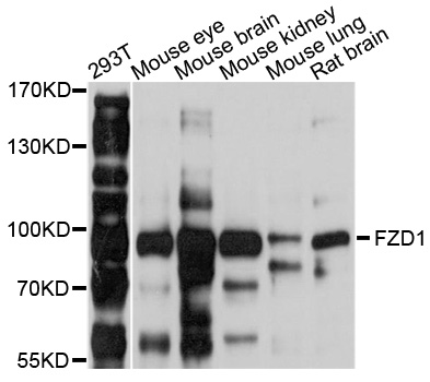 FZD1 / Frizzled 1 Antibody - Western blot analysis of extracts of various cell lines, using FZD1 antibody at 1:1000 dilution. The secondary antibody used was an HRP Goat Anti-Rabbit IgG (H+L) at 1:10000 dilution. Lysates were loaded 25ug per lane and 3% nonfat dry milk in TBST was used for blocking. An ECL Kit was used for detection and the exposure time was 1s.