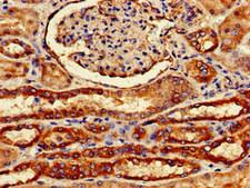 FZD1 / Frizzled 1 Antibody - Immunohistochemistry of paraffin-embedded human kidney tissue at dilution of 1:100