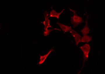 FZD1 / Frizzled 1 Antibody - Staining HeLa cells by IF/ICC. The samples were fixed with PFA and permeabilized in 0.1% Triton X-100, then blocked in 10% serum for 45 min at 25°C. The primary antibody was diluted at 1:200 and incubated with the sample for 1 hour at 37°C. An Alexa Fluor 594 conjugated goat anti-rabbit IgG (H+L) Ab, diluted at 1/600, was used as the secondary antibody.