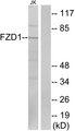 FZD1 / Frizzled 1 Antibody - Western blot analysis of extracts from Jurkat cells, using FZD1 antibody.