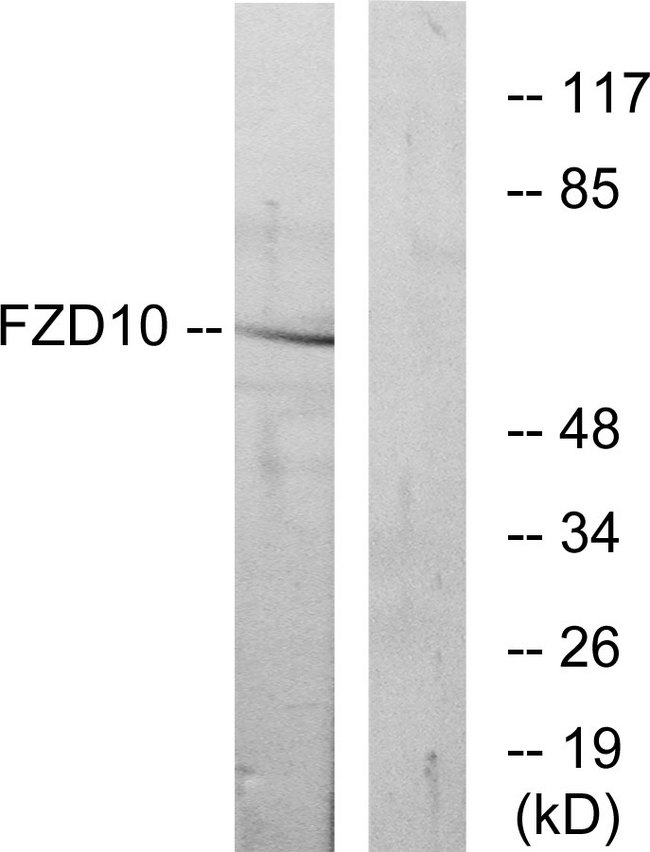 FZD10 / Frizzled 10 Antibody - Western blot analysis of lysates from COS7 cells, using FZD10 Antibody. The lane on the right is blocked with the synthesized peptide.