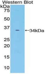 FZD10 / Frizzled 10 Antibody - Western blot of recombinant FZD10 / Frizzled 10.  This image was taken for the unconjugated form of this product. Other forms have not been tested.