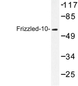 FZD10 / Frizzled 10 Antibody - Western blot of Frizzled-10 (L164) pAb in extracts from COS-7 cells.