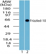 FZD10 / Frizzled 10 Antibody - Western blot of Frizzled-10 in human brain lysate. Lane 1 shows pre-immune sera and Lanes 2 show Polyclonal Antibody to Frizzled-10 (FZD10) tested on human at 1:1000 dilution.