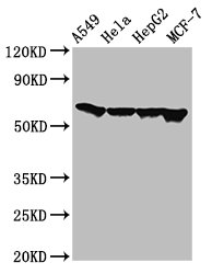 FZD10 / Frizzled 10 Antibody - Positive Western Blot detected in A549 whole cell lysate, Hela whole cell lysate, HepG2 whole cell lysate, MCF-7 whole cell lysate. All lanes: FZD10 antibody at 3 µg/ml Secondary Goat polyclonal to rabbit IgG at 1/50000 dilution. Predicted band size: 66 KDa. Observed band size: 66 KDa