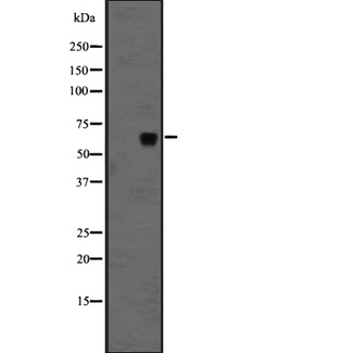 FZD10 / Frizzled 10 Antibody - Western blot analysis of FZD10 expression in H1299 whole cells lysate. The lane on the left is treated with the antigen-specific peptide.