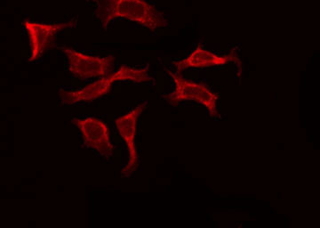 FZD10 / Frizzled 10 Antibody - Staining COS7 cells by IF/ICC. The samples were fixed with PFA and permeabilized in 0.1% Triton X-100, then blocked in 10% serum for 45 min at 25°C. The primary antibody was diluted at 1:200 and incubated with the sample for 1 hour at 37°C. An Alexa Fluor 594 conjugated goat anti-rabbit IgG (H+L) Ab, diluted at 1/600, was used as the secondary antibody.