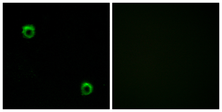 FZD2 / Frizzled 2 Antibody - Immunofluorescence analysis of MCF7 cells, using FZD2 Antibody. The picture on the right is blocked with the synthesized peptide.