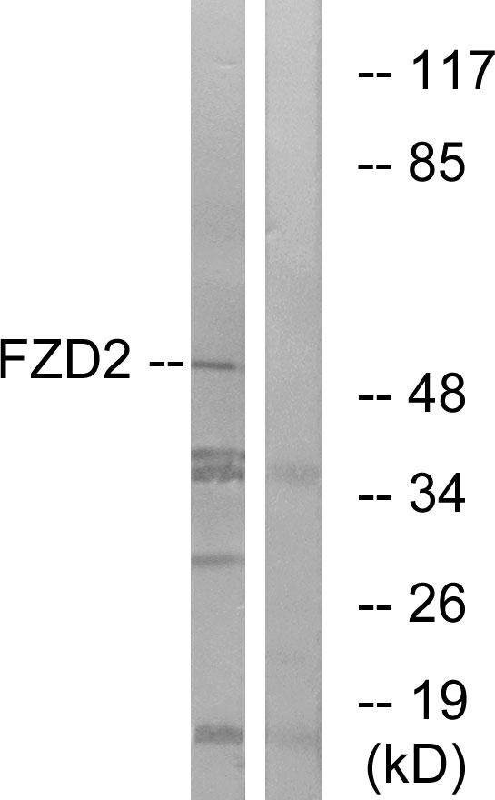 FZD2 / Frizzled 2 Antibody - Western blot analysis of lysates from HeLa cells, using FZD2 Antibody. The lane on the right is blocked with the synthesized peptide.