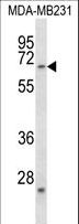 FZD2 / Frizzled 2 Antibody - FZD2 Antibody western blot of MDA-MB231 cell line lysates (35 ug/lane). The FZD2 antibody detected the FZD2 protein (arrow).