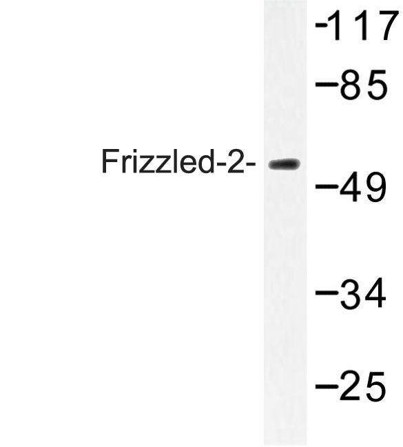 FZD2 / Frizzled 2 Antibody - Western blot of Frizzled-2 (E240) pAb in extracts from HeLa cells.