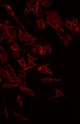 FZD2 / Frizzled 2 Antibody - Staining HeLa cells by IF/ICC. The samples were fixed with PFA and permeabilized in 0.1% Triton X-100, then blocked in 10% serum for 45 min at 25°C. The primary antibody was diluted at 1:200 and incubated with the sample for 1 hour at 37°C. An Alexa Fluor 594 conjugated goat anti-rabbit IgG (H+L) Ab, diluted at 1/600, was used as the secondary antibody.