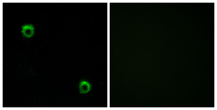 FZD2 / Frizzled 2 Antibody - Peptide - + Immunofluorescence analysis of MCF-7 cells, using FZD2 antibody.