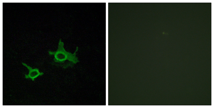 FZD3 / Frizzled 3 Antibody - Immunofluorescence analysis of COS7 cells, using FZD3 Antibody. The picture on the right is blocked with the synthesized peptide.