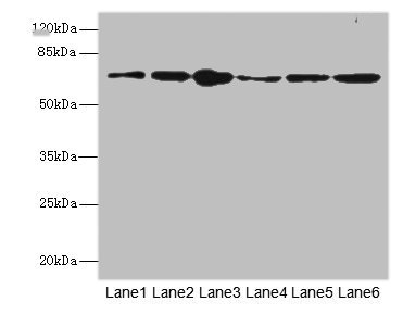 FZD3 / Frizzled 3 Antibody - Western blot All Lanes: FZD3 antibody at 1.94ug/ml Lane 1: Rat heart tissue Lane 2: U251 whole cell lysate Lane 3: Thp-1 whole cell lysate Lane 4: 293T whole cell lysate Lane 5: Hela whole cell lysate Lane 6: HepG-2 whole cell lysate Secondary Goat polyclonal to rabbit IgG at 1/10000 dilution Predicted band size: 76 kDa Observed band size: 76 kDa