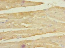 FZD3 / Frizzled 3 Antibody - Immunohistochemistry of paraffin-embedded human skeletal muscle tissue at dilution 1:100