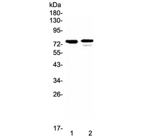 FZD3 / Frizzled 3 Antibody - Western blot testing of human 1) SK-OV-3 and 2) Jurkat lystate with FZD3 antibody at 0.5ug/ml. Predicted molecular weight ~76 kDa.