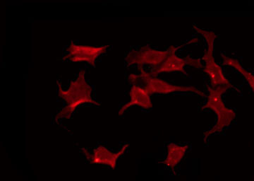 FZD3 / Frizzled 3 Antibody - Staining A549 cells by IF/ICC. The samples were fixed with PFA and permeabilized in 0.1% Triton X-100, then blocked in 10% serum for 45 min at 25°C. The primary antibody was diluted at 1:200 and incubated with the sample for 1 hour at 37°C. An Alexa Fluor 594 conjugated goat anti-rabbit IgG (H+L) Ab, diluted at 1/600, was used as the secondary antibody.