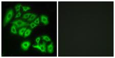 FZD4 / Frizzled 4 Antibody - Immunofluorescence analysis of A549 cells, using FZD4 Antibody. The picture on the right is blocked with the synthesized peptide.
