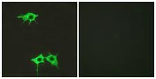 FZD4 / Frizzled 4 Antibody - Immunofluorescence analysis of LOVO cells, using FZD4 Antibody. The picture on the right is blocked with the synthesized peptide.