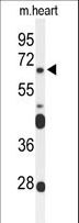 FZD4 / Frizzled 4 Antibody - Western blot of FZD4 Antibody in mouse heart tissue lysates (35 ug/lane). FZD4 (arrow) was detected using the purified antibody.