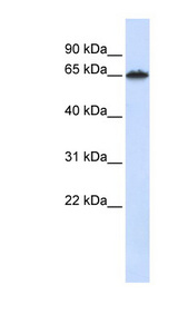 FZD4 / Frizzled 4 Antibody - FZD4 / Frizzled 4 antibody Western blot of Fetal Liver lysate. This image was taken for the unconjugated form of this product. Other forms have not been tested.